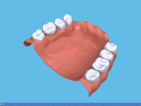 denture fixative